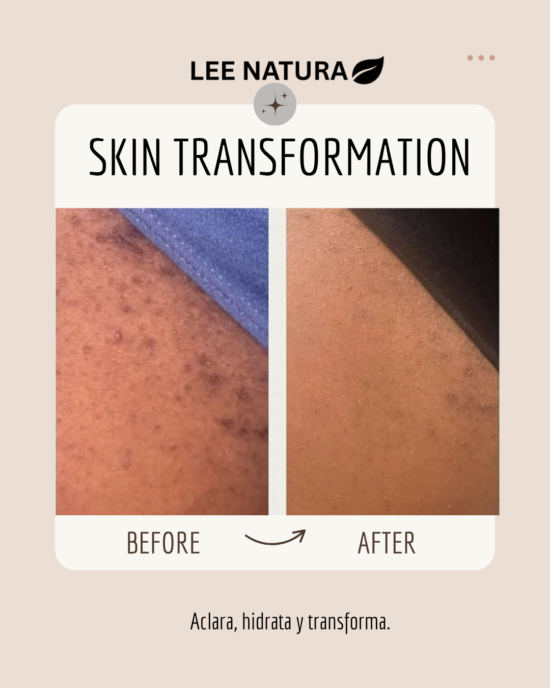 BRIGHTENING OIL - BODY ELIXIR