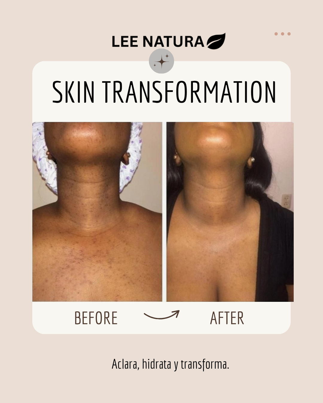 BRIGHTENING OIL - BODY ELIXIR