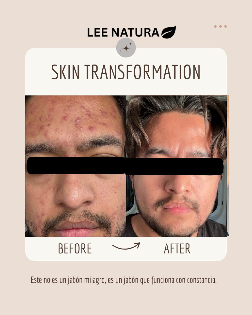 ACTIVATED CHARCOAL & TEA TREE SOAP