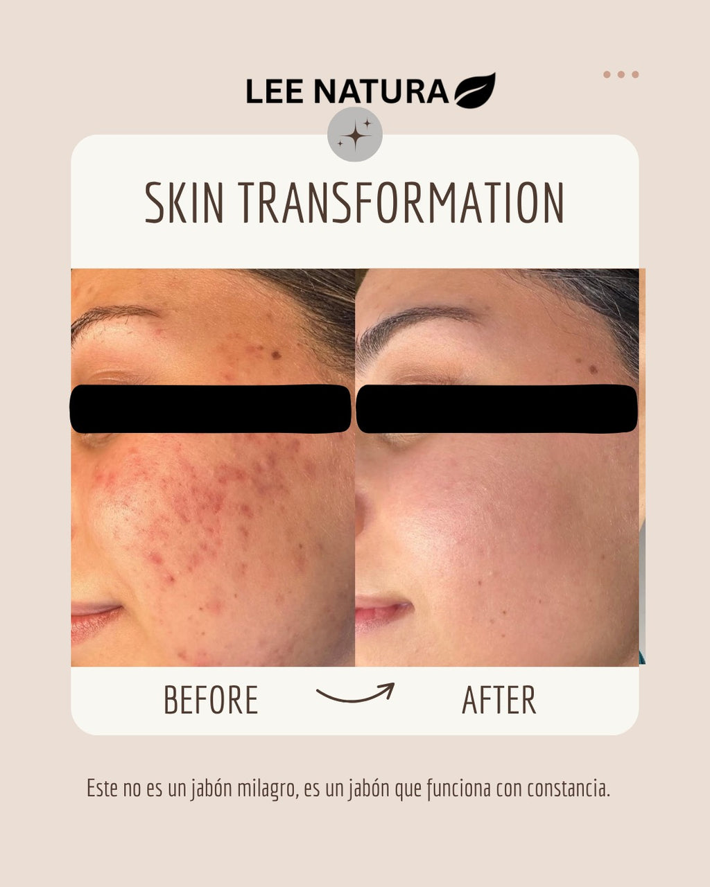 ACTIVATED CHARCOAL & TEA TREE SOAP