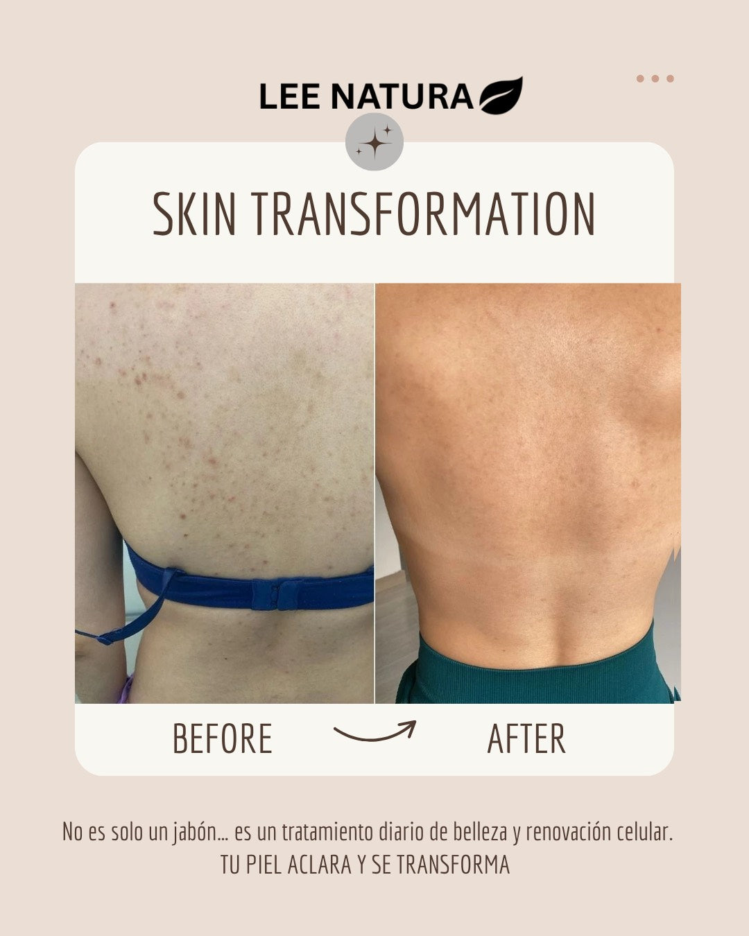 RICE RAW PULP, VITAMIN E & GOAT MILK