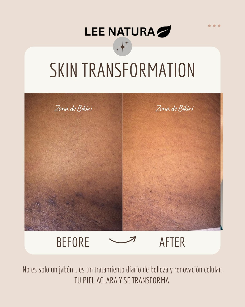 RICE RAW PULP, VITAMIN E & GOAT MILK