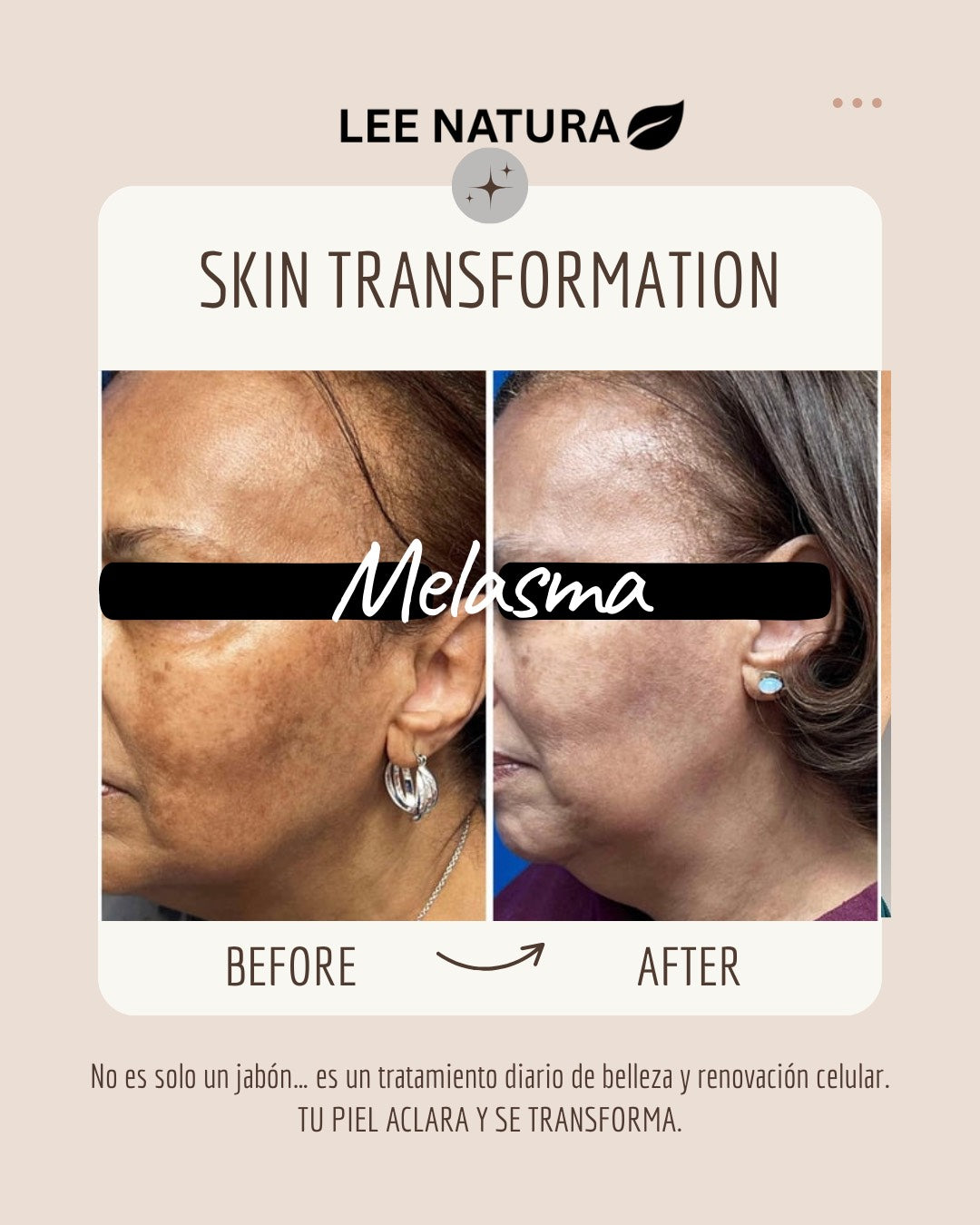 RICE RAW PULP, VITAMIN E & GOAT MILK