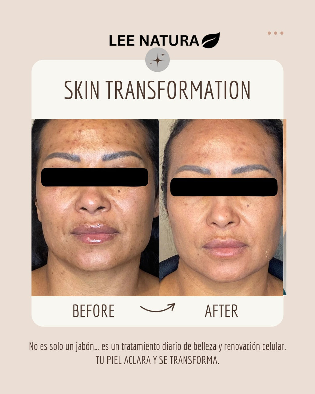 RICE RAW PULP, VITAMIN E & GOAT MILK