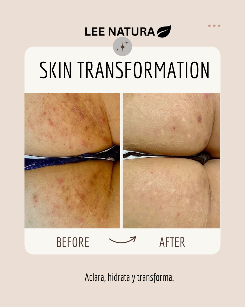 BRIGHTENING OIL - BODY ELIXIR