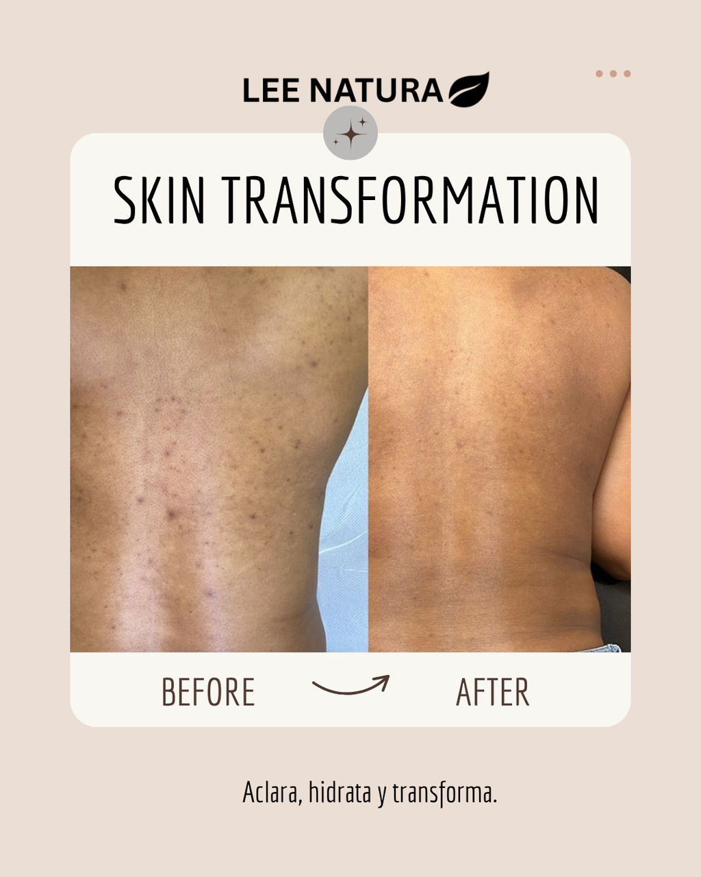 BRIGHTENING OIL - BODY ELIXIR